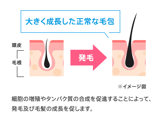 大きく成長した正常な毛包 頭皮 毛根 発毛 ※イメージ図 細胞の増殖やタンパク質の合成を促進することによって、発毛及び毛髪の成長を促します。